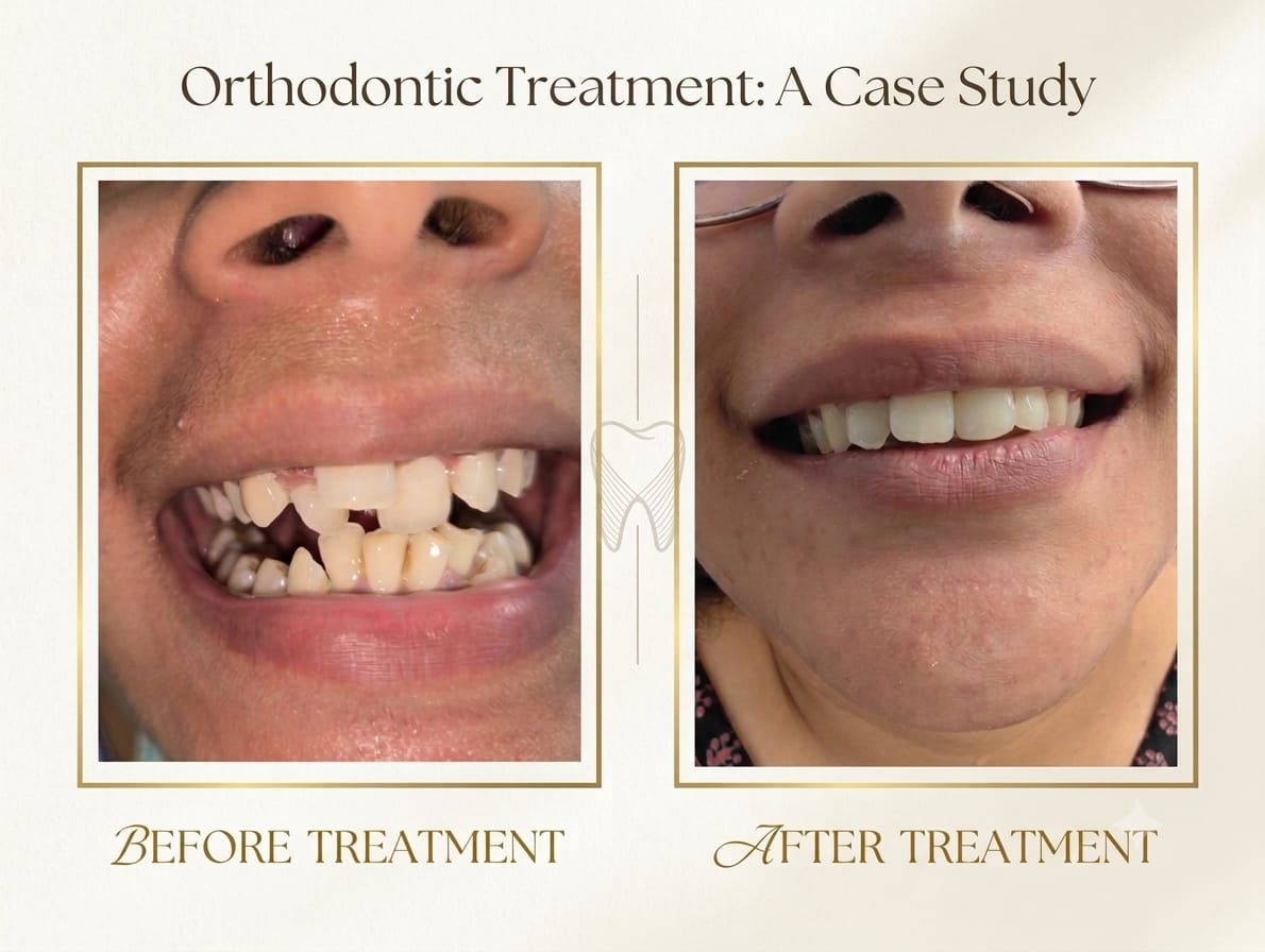 Orthodontic Treatment Case Study